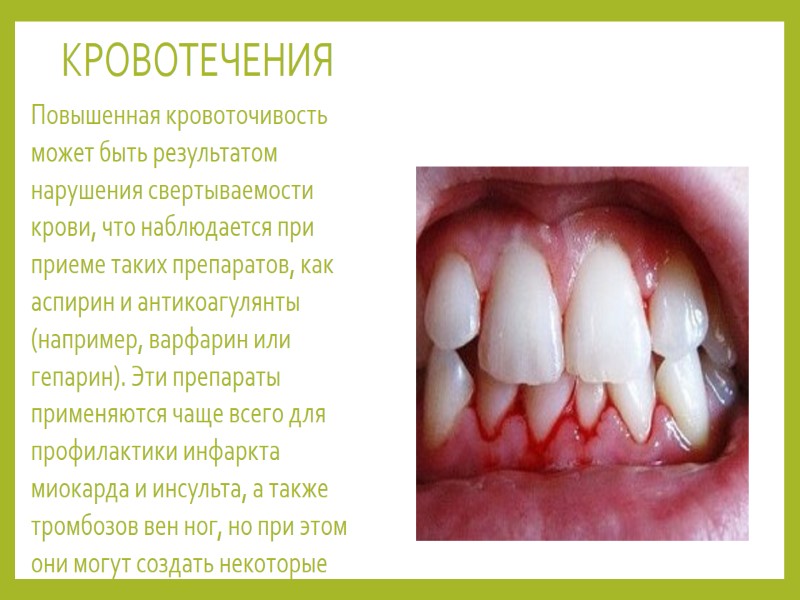 КРОВОТЕЧЕНИЯ  Повышенная кровоточивость может быть результатом нарушения свертываемости крови, что наблюдается при приеме